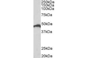 Western Blotting (WB) image for anti-Interferon Regulatory Factor 4 (IRF4) (AA 433-445) antibody (ABIN1102606) (IRF4 antibody  (AA 433-445))