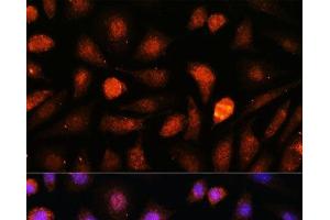 Immunofluorescence analysis of L-929 cells using CDK5RAP1 Polyclonal Antibody at dilution of 1:100. (CDK5RAP1 antibody)