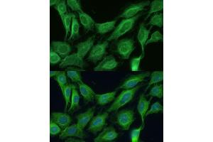 Immunofluorescence analysis of C6 cells using CNNM1 antibody (ABIN7266572) at dilution of 1:100. (Cyclin M1 antibody  (AA 692-951))
