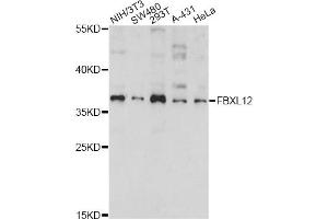 Western blot analysis of extracts of various cell lines, using FBXL12 antibody. (FBXL12 antibody)