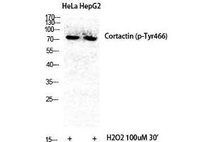 Western Blot (WB) analysis of specific cells using Phospho-Cortactin (Y466) Polyclonal Antibody. (Cortactin antibody  (pTyr466))