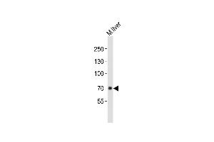 Anti-ALB Antibody (C-term)at 1:1000 dilution + mouse liver lysates Lysates/proteins at 20 μg per lane. (Albumin antibody  (C-Term))