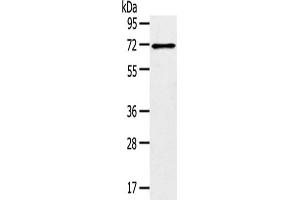 Gel: 8 % SDS-PAGE,Lysate: 40 μg,Primary antibody: ABIN7192909(TRIM47 Antibody) at dilution 1/300 dilution,Secondary antibody: Goat anti rabbit IgG at 1/8000 dilution,Exposure time: 1 minute (TRIM47 antibody)