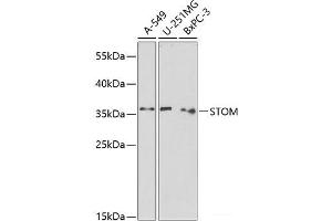 Western blot analysis of extracts of various cell lines using STOM Polyclonal Antibody at dilution of 1:1000. (Stomatin antibody)