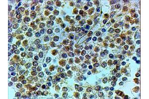 ABIN2560562 (4µg/ml) staining of paraffin embedded Human Spleen. (LRRFIP1 antibody  (C-Term))
