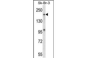 Western blot analysis in SK-BR-3 cell line lysates (35ug/lane). (MAP4K4 antibody  (AA 506-534))