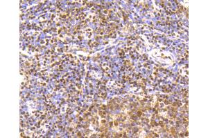 Immunohistochemistry of paraffin-embedded human tonsil using CREB1 antibody (ABIN4903372) at dilution of 1:100 (40x lens). (CREB1 antibody)