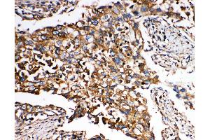 Immunohistochemistry (IHC) image for anti-SMAD, Mothers Against DPP Homolog 5 (SMAD5) (AA 248-267), (Middle Region) antibody (ABIN3043980)