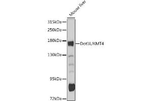 Western blot analysis of extracts of mouse liver, using Dot1L/KMT4 antibody (ABIN6130310, ABIN6139773, ABIN6139777 and ABIN6215149) at 1:1000 dilution. (DOT1L antibody  (AA 1-250))