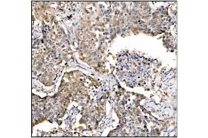 IHC analysis of Caspase-9/CASP9 using anti-Caspase-9/CASP9 antibody (ABIN7600340). (Caspase 9 antibody  (AA 18-416))
