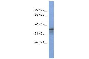 WB Suggested Anti-RBM9  Antibody Titration: 0. (RBM9 antibody  (Middle Region))