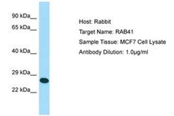 RAB41 antibody  (N-Term)