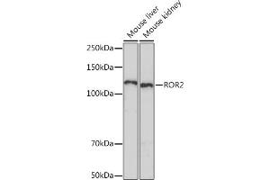 Western blot analysis of extracts of various cell lines, using ROR2 Rabbit mAb (ABIN7269888) at 1:1000 dilution. (ROR2 antibody)