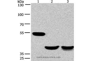 Western blot analysis of Mouse brain and human fetal muscle tissue, mouse heart tissue, using CABLES1 Polyclonal Antibody at dilution of 1:650 (CABLES1 antibody)