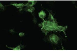 Immunofluorescence - anti-RFP Ab in 293HEK cells transfected with RFP at 1/50 dilution, cells Were fixed with 4% of PFA (RFP antibody)