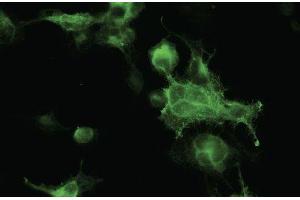 Immunofluorescence - anti-RFP Ab in 293HEK cells transfected with RFP at 1/50 dilution, cells Were fixed with 4% of PFA