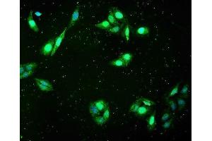 IF analysis of FHL using anti-FHL antibody (ABIN7600488).