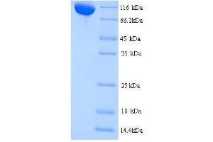 SDS-PAGE (SDS) image for CCCTC-Binding Factor (Zinc Finger Protein)-Like (CTCFL) (AA 1-636), (full length) protein (His tag) (ABIN4976778) (CTCFL Protein (AA 1-636, full length) (His tag))