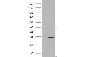 Western Blotting (WB) image for anti-MOB Kinase Activator 3B (MOB3B) antibody (ABIN1499539) (MOBKL2B antibody)