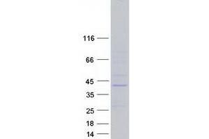 Validation with Western Blot