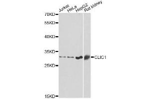 Western blot analysis of extracts of various cell lines, using CLIC1 antibody. (CLIC1 antibody  (AA 42-241))