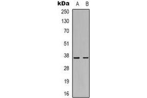 Western blot analysis of GHITM expression in Hela (A), Ramos (B) whole cell lysates. (GHITM antibody)