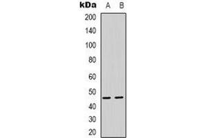 Western blot analysis of PSMD11 expression in Hela (A), HEK293T (B) whole cell lysates. (PSMD11 antibody)