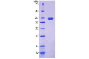 Image no. 1 for Acyl-Coenzyme A Oxidase 2 (ACX2) (AA 49-308) protein (T7 tag,His tag) (ABIN6239494) (ACX2 Protein (AA 49-308) (T7 tag,His tag))