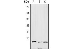 Western blot analysis of SNRPD3 expression in Jurkat (A), mouse brain (B), H9C2 (C) whole cell lysates.