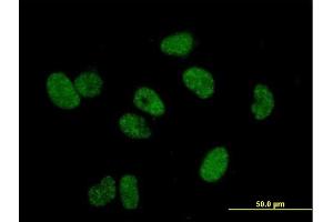 Immunofluorescence of purified MaxPab antibody to TERF1 on HeLa cell. (TRF1 antibody  (AA 1-439))