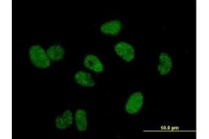 Immunofluorescence of purified MaxPab antibody to TERF1 on HeLa cell. (TRF1 antibody  (AA 1-439))