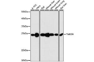 Western blot analysis of extracts of various cell lines, using TMED9 antibody. (TMED9 antibody  (AA 1-224))