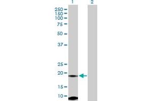 Western Blot analysis of FUNDC2 expression in transfected 293T cell line by FUNDC2 MaxPab polyclonal antibody. (FUNDC2 antibody  (AA 1-189))