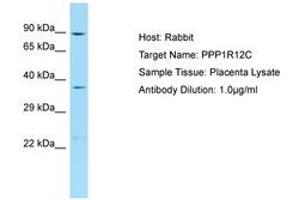 Image no. 1 for anti-Protein Phosphatase 1, Regulatory Subunit 12C (PPP1R12C) (AA 571-620) antibody (ABIN6750225) (PPP1R12C antibody  (AA 571-620))