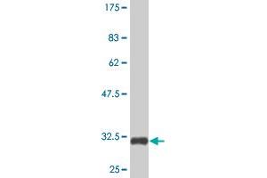 Western Blot detection against Immunogen (32. (TXNDC3/NME8 antibody  (AA 530-586))