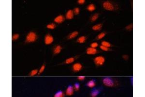 Immunofluorescence analysis of NIH-3T3 cells using ZNF416 Polyclonal Antibody at dilution of 1:100. (ZNF416 antibody)