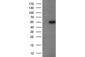 Western Blotting (WB) image for anti-Glucosidase, Beta, Acid 3 (Cytosolic) (GBA3) (AA 1-150), (AA 370-469) antibody (ABIN1490584) (GBA3 antibody  (AA 1-150, AA 370-469))
