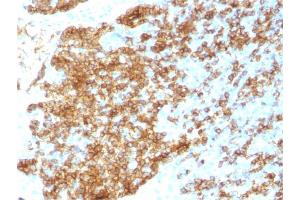 Formalin-fixed, paraffin-embedded human Tonsil stained with CD45RB Rabbit Recombinant Monoclonal Antibody (PTPRC/1783R). (Recombinant CD45 antibody)