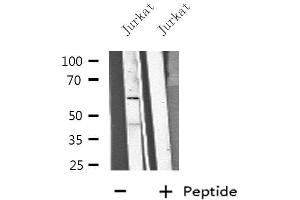 Western blot analysis of extracts from Jurkat cells, using CP1B1 antibody. (CYP1B1 antibody  (Internal Region))