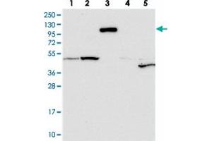 Western blot analysis of Lane 1: RT-4, Lane 2: U-251 MG, Lane 3: Human Plasma, Lane 4: Liver, Lane 5: Tonsil with CNTN5 polyclonal antibody  at 1:250-1:500 dilution.