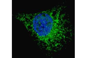 Fluorescent image of  cells stained with (ABIN388463 and ABIN2849510) LC3 (G8A) antibody. (MAP1LC3A antibody)