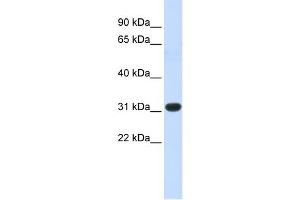 WB Suggested Anti-HOXC8 Antibody Titration: 1 ug/ml Positive Control: Fetal Muscle cell lysate (HOXC8 antibody  (N-Term))