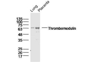 Lane 1: Lung lysates Lane 2: Placenta lysates probed with Thrombomodulin Polyclonal Antibody, Unconjugated  at 1:300 dilution and 4˚C overnight incubation. (Thrombomodulin antibody  (AA 21-120))