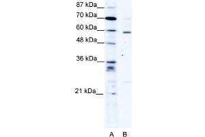 WB Suggested Anti-PDLIM5 Antibody Titration:  1. (PDLIM5 antibody  (Middle Region))