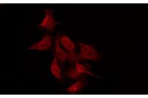 ABIN6276019 staining Hela by IF/ICC. (GPR158 antibody  (N-Term))