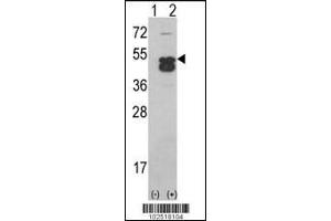 Western blot analysis of CAMK1D using CAMK1D (CAMK1 delta)Antibody using 293 cell lysates (2 ug/lane) either nontransfected (Lane 1) or transiently transfected with the CAMK1D gene (Lane 2).