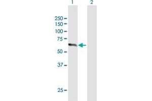 Western Blot analysis of ZNF18 expression in transfected 293T cell line by ZNF18 MaxPab polyclonal antibody. (ZNF18 antibody  (AA 1-549))