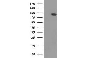 HEK293T cells were transfected with the pCMV6-ENTRY control (Left lane) or pCMV6-ENTRY DLG3 (Right lane) cDNA for 48 hrs and lysed. (DLG3 antibody)