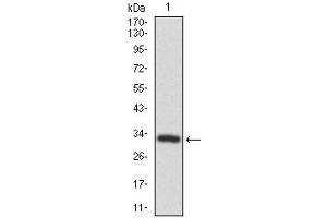 Western blot analysis using FZD5 mAb against human FZD5 recombinant protein.