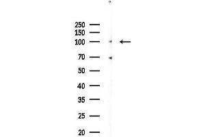 anti-DEAD (Asp-Glu-Ala-Asp) Box Polypeptide 42 (DDX42) (C-Term) antibody